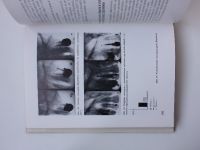 Kotula - Ošetrenie devitálnych zubov (1984) stomatologie - slovensky
