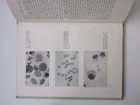 Šimeček - Cytologická vyšetření v pneumologii (1963)