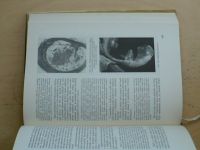 Patologická anatomie I. - I./II. a II./II. (1963) 3 knihy