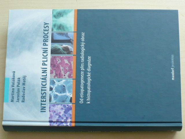 Intersticiální plicní procesy (2011)