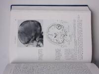 Bodechtel - Differentialdiagnose neurologischer Krankheitsbilder (1963) německy - diagnostika